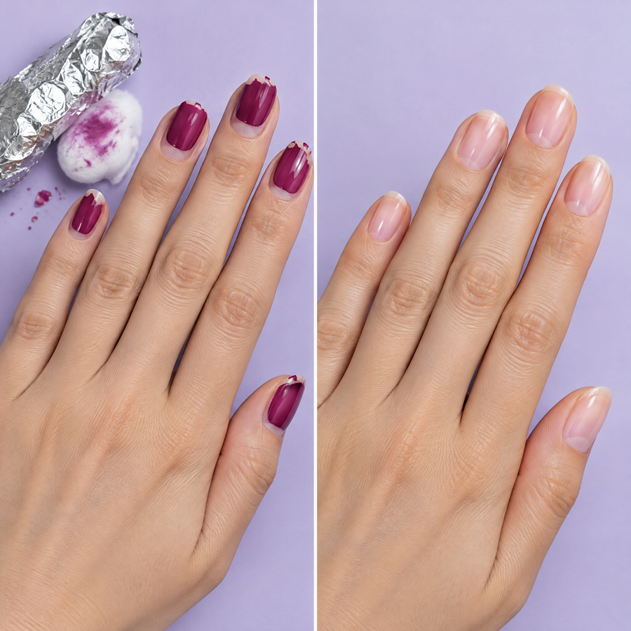 Chipped gel nails next to clean bare nails